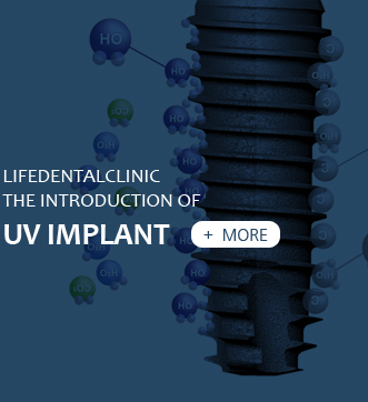 UV 임플란트