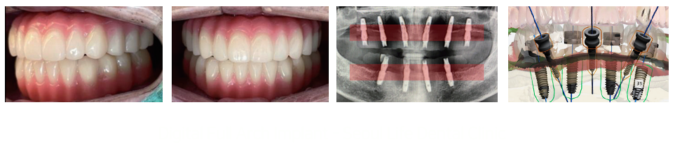 서울라이프치과